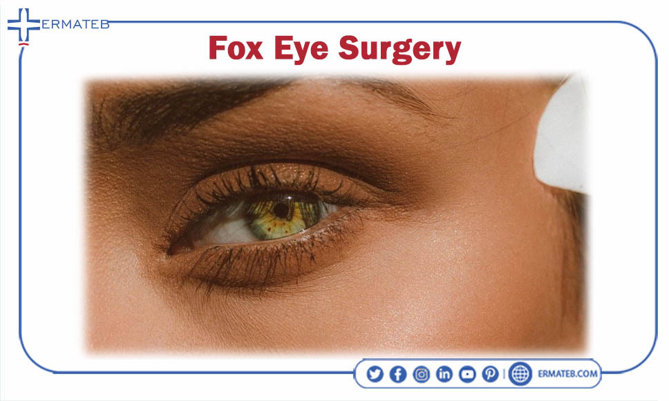 foxy eye surgery